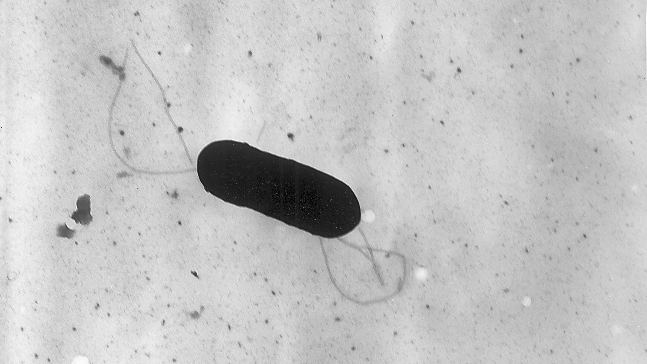 listeria